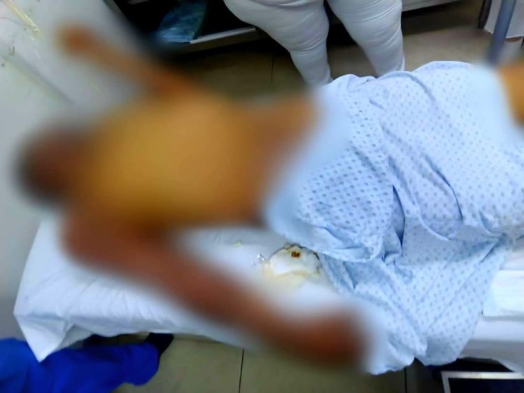 Le propinan brutal golpiza a un joven y lo abandonan frente a su casa moribundo, en Apatzingán